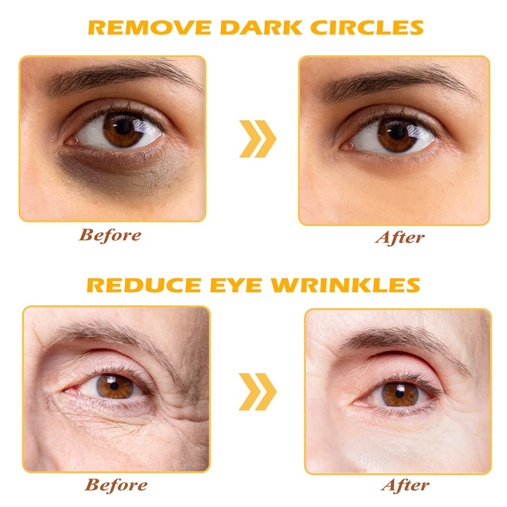 Organic 24K Gold Collagen Eye Mask Anti-Dark Circles, Puffiness & Wrinkle-Reducing Under Eye Patches
