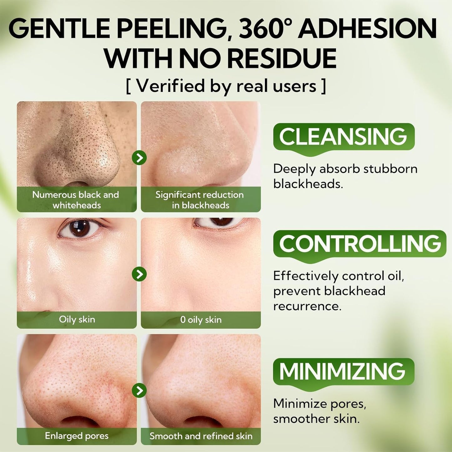 Organic Nose Blackhead Remover Strips, Pore Shrinking Acne Treatment Patches (5–100 PCS)