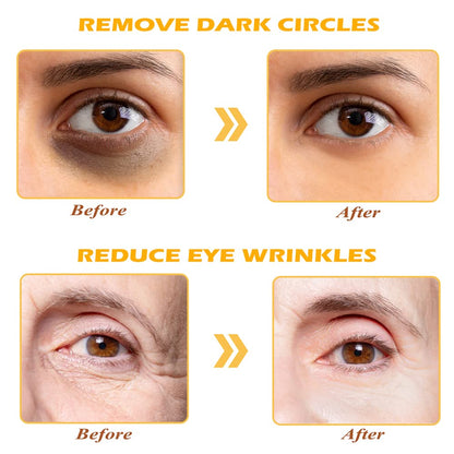 Organic 24K Gold Collagen Eye Mask Anti-Dark Circles, Puffiness & Wrinkle-Reducing Under Eye Patches